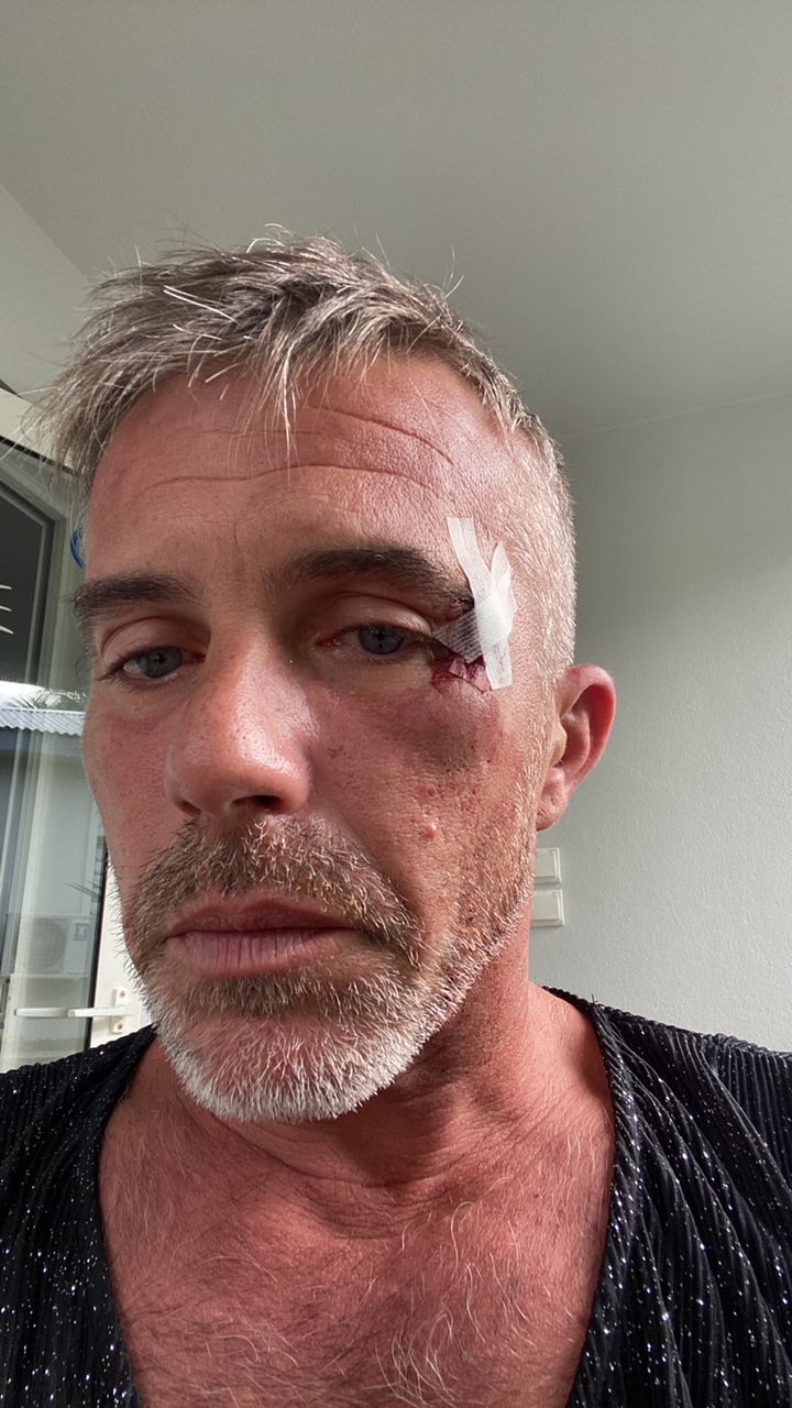 Samuel Perche, président de Requeer, agressé à la sortie du Shamrock’s