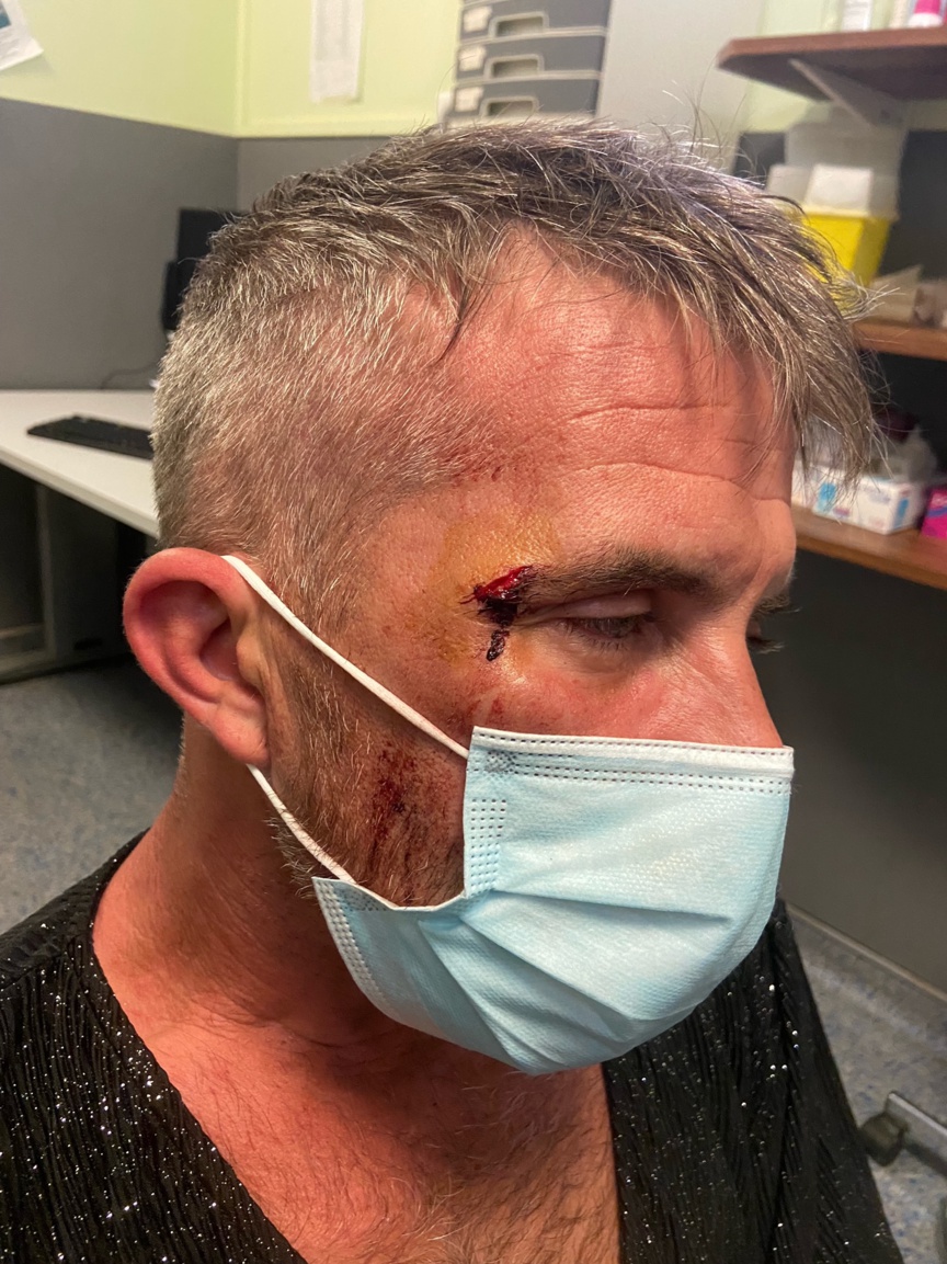 Samuel Perche, président de Requeer, agressé à la sortie du Shamrock’s Samuel Perche, président de Requeer, agressé à la sortie du Shamrock’s