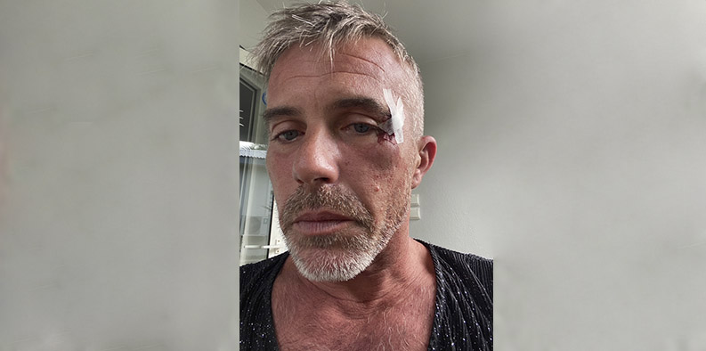 Samuel Perche, président de Requeer, agressé à la sortie du Shamrock’s